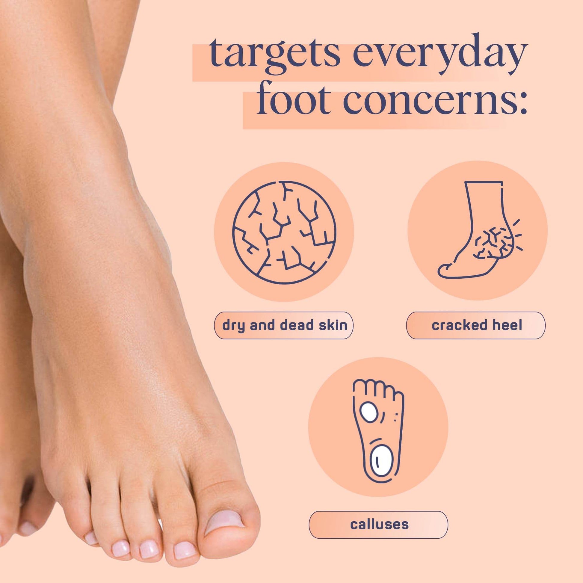 SpaLife Softening Care Foot Sockies (8-Pack) - Spearmint & Tea Tree Oil, Exfoliating Pack for Healthy Feet, Intensive Repair, Callus Remover Sockies, Dry Skin Solution, Moisturizing Foot Treatment - zenfulharmony.com